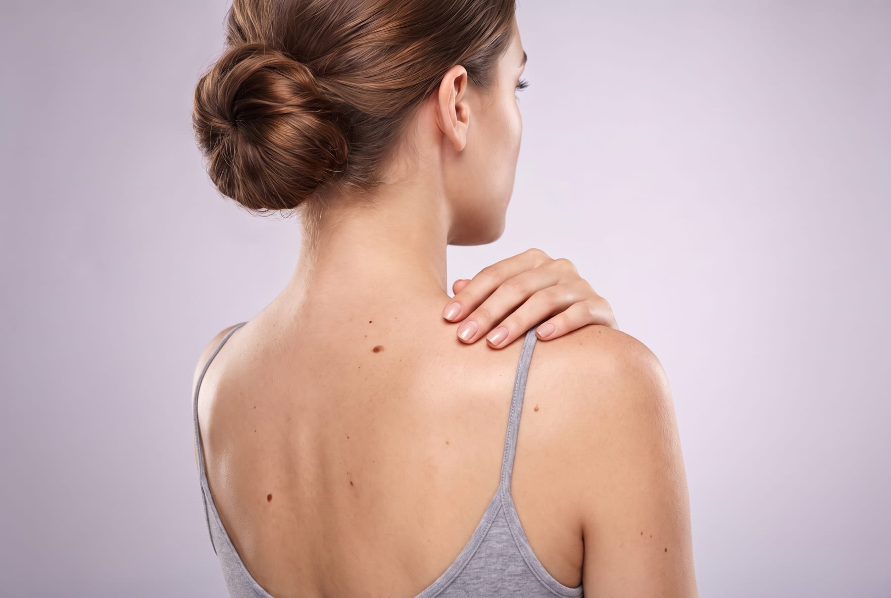Skin lesions and moles
